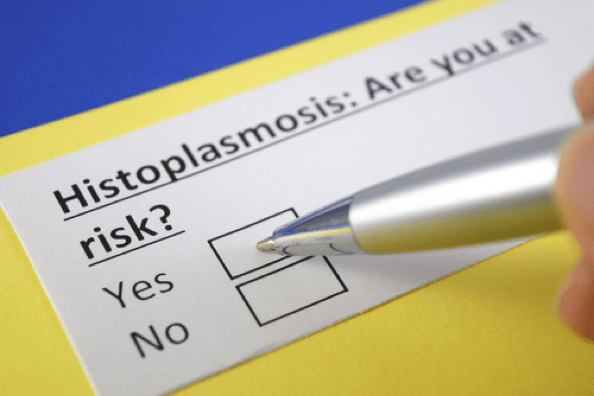 Histoplasmosis